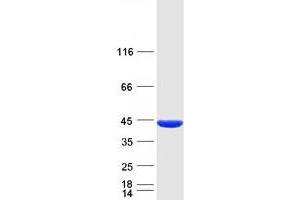 Validation with Western Blot