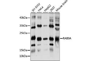 Western blot analysis of extracts of various cell lines, using RA antibody (ABIN7269818) at 1:1000 dilution. (RAB9A anticorps  (AA 1-201))
