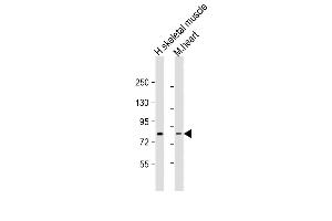 Western blot analysis of anti-Leo1 Antibody (N-term) (ABIN388697 and ABIN2838783) in HL60 cell line lysates (35 μg/lane). (LEO1 anticorps  (N-Term))