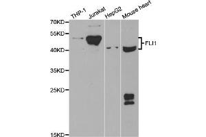 Western blot analysis of extracts of various cell lines, using FLI1 antibody (ABIN5973290) at 1/1000 dilution. (FLI1 anticorps)