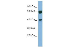 RAB3IL1 antibody used at 1 ug/ml to detect target protein. (RAB3IL1 anticorps)