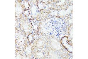 Immunohistochemistry of paraffin-embedded mouse kidney using ErbB2 antibody.