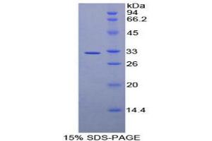 SDS-PAGE analysis of Human AMY2 Protein. (AMY2 Protéine)
