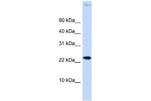 CHRAC1 antibody used at 0. (CHRAC1 anticorps  (Middle Region))