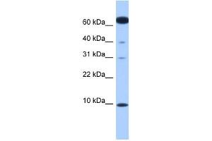 DYNLL2 antibody used at 1 ug/ml to detect target protein. (DYNLL2 anticorps  (N-Term))