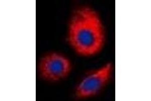 Immunofluorescent analysis of ERGIC3 staining in MCF7 cells.