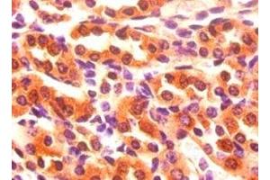 Immunohistochemistry of paraffin-embedded mouse kidney tissue using ABIN7152629 at dilution of 1:50