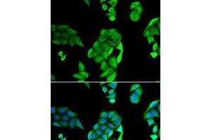Immunofluorescence analysis of U2OS cells using NOL3 Polyclonal Antibody