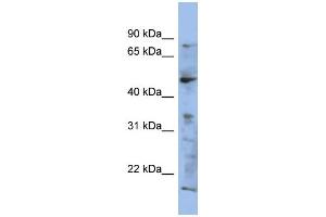 WB Suggested Anti-RAB3IP Antibody Titration: 0. (RAB3IP anticorps  (N-Term))