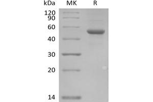 Immunoglobulin-Like Domain Containing Receptor 2 (ILDR2) protein (Fc Tag)