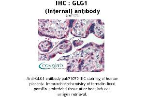 Image no. 2 for anti-Golgi Glycoprotein 1 (GLG1) (Internal Region) antibody (ABIN1734713)