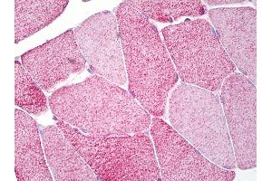 Anti-EOMES antibody IHC of human skeletal muscle.