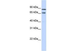Image no. 1 for anti-IKAROS Family Zinc Finger 1 (Ikaros) (IKZF1) (AA 252-301) antibody (ABIN6742212) (IKZF1 anticorps  (AA 252-301))
