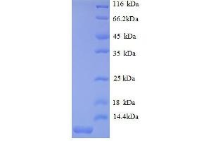 Chemokine (C-X-C Motif) Ligand 2 (CXCL2) (AA 28-100), (full length) protein (His tag)
