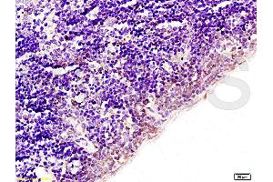 Formalin-fixed and paraffin embedded rat spleen tissue labeled with Anti-Acetyl-Histone H1b(K53) Polyclonal Antibody (ABIN729973), Unconjugated at 1:200, followed by conjugation to the secondary antibody and DAB staining (Histone H1 anticorps  (acLys52))