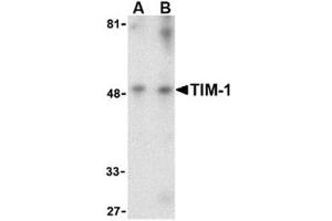 Image no. 1 for anti-Hepatitis A Virus Cellular Receptor 1 (HAVCR1) (Middle Region) antibody (ABIN318765) (HAVCR1 anticorps  (Middle Region))