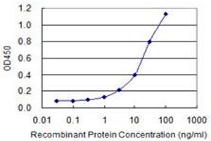 Detection limit for recombinant GST tagged CTBS is 0.