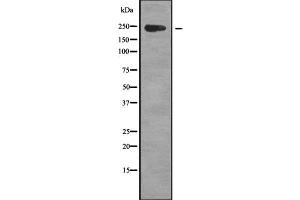 Western blot analysis of CCDC131 using Jurkat whole cell lysates (ZFC3H1 anticorps  (Internal Region))