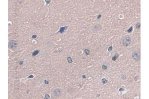 Detection of GPX3 in Mouse Cerebrum Tissue using Polyclonal Antibody to Glutathione Peroxidase 3, Plasma (GPX3)