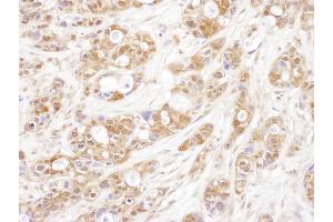 Immunohistochemistry (IHC) image for anti-Cyclin-Dependent Kinase 5, Regulatory Subunit 1 (p35) (CDK5R1) (AA 110-160) antibody (ABIN7453924)