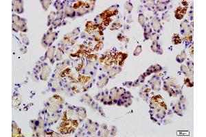 Formalin-fixed and paraffin embedded rat pancreas tissue labeled with Anti-GLUT10/Glucose Transporter GLUT10 Polyclonal Antibody, Unconjugated (ABIN873017) at 1:200 followed by conjugation to the secondary antibody