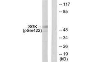 Western blot analysis of extracts from HeLa cells treated with Insulin 0. (SGK1 anticorps  (pSer422))