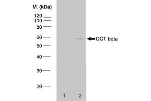 Western blot analysis of HeLa whole cell lysate (1) and HeLa heat stressed whole cell (CCT2 anticorps)