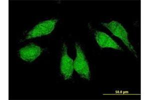 Immunofluorescence of purified MaxPab antibody to CRKL on HeLa cell.