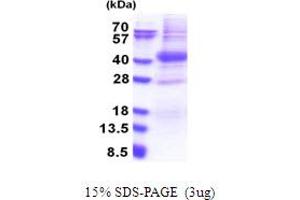 SDS-PAGE (SDS) image for Proto-Oncogene Pim-2 (Serine Threonine Kinase) (PIM2) (AA 1-311) protein (His tag) (ABIN5778259) (PIM2 Protein (AA 1-311) (His tag))