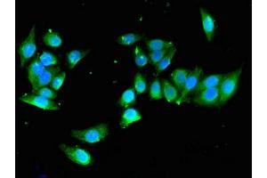 Immunofluorescent analysis of PC-3 cells using ABIN7166338 at dilution of 1:100 and Alexa Fluor 488-congugated AffiniPure Goat Anti-Rabbit IgG(H+L)