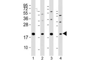 Western blot testing of human 1) HeLa, 2) PC-3, 3) T47D and 4) U-2OS cell lysate with APC11 antibody at 1:2000. (ANAPC11 anticorps  (AA 56-94))