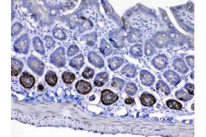 IHC analysis of IGF1 Receptor using anti-IGF1 Receptor antibody .