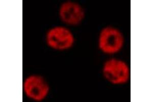 ABIN6267510 staining HeLa by IF/ICC.