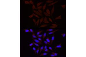 Immunofluorescence analysis of HeLa using FA/PIEZO1 antibody (ABIN6133207, ABIN6145612, ABIN6145613 and ABIN6220594) at dilution of 1:100 (40x lens).