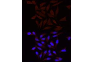 Immunofluorescence analysis of HeLa using FA/PIEZO1 antibody (ABIN6133207, ABIN6145612, ABIN6145613 and ABIN6220594) at dilution of 1:100 (40x lens). (PIEZO1 anticorps  (AA 2230-2420))