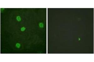 Immunofluorescence analysis of HeLa cells, using B-Myb (Phospho-Ser577/581) Antibody. (MYBL2 anticorps  (pSer577))