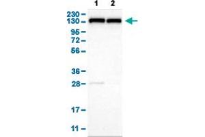 Western Blot analysis of (1) human cell line RT-4, and (2) human cell line U-251MG sp. (UBE4B anticorps  (AA 2-67))