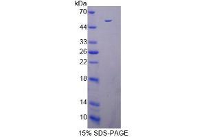SDS-PAGE analysis of Mouse DAPK3 Protein.