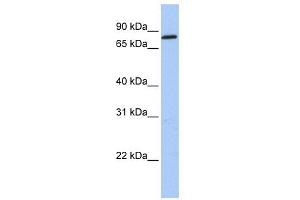 WB Suggested Anti-ZNF226 Antibody Titration:  0. (ZNF226 anticorps  (C-Term))