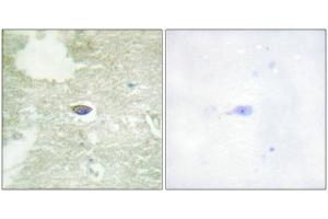 Immunohistochemical analysis of paraffin-embedded human brain tissue using TGF β Receptor II (Phospho-Ser225/250) antibody (left)or the same antibody preincubated with blocking peptide (right).