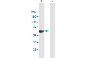 Western Blot analysis of TOM1 expression in transfected 293T cell line by TOM1 MaxPab polyclonal antibody. (TOM1 anticorps  (AA 1-492))