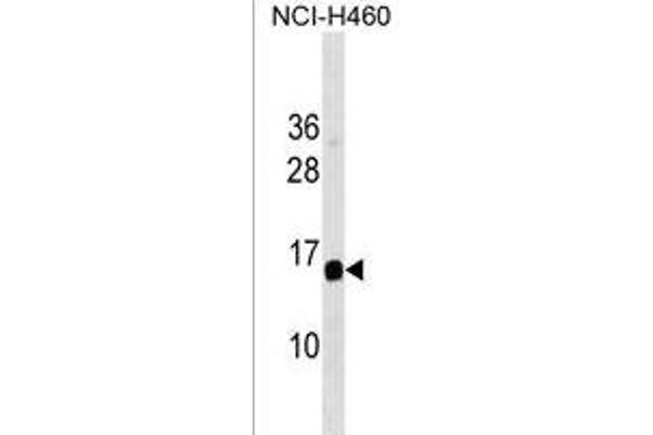 GAPT antibody  (AA 84-112)
