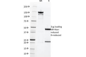 SDS-PAGE Analysis of Purified HCG-beta Rabbit Recombinant Monoclonal Antibody (HCGb/1996R). (Recombinant CGB anticorps)
