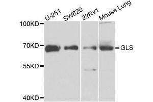 Western blot analysis of extracts of various cell lines, using GLS antibody.