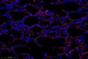 Immunofluorescent analysis of paraformaldehyde-fixed rat lung using,OMD (ABIN7074956) at dilution of 1: 1000