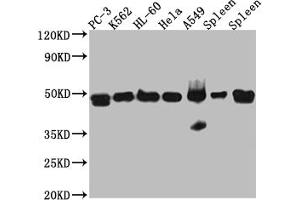 Western Blot Positive WB detected in: PC-3 whole cell lysate, K562 whole cell lysate, HL-60 whole cell lysate, A549 whole cell lysate, Mouse Spleen whole cell lysate, Rat Spleen whole cell lysate All lanes: Arp3 Antibody at 1:1000 Secondary Goat polyclonal to rabbit IgG at 1/50000 dilution Predicted band size: 48 kDa Observed band size: 48 kDa (Recombinant ACTR3 anticorps)