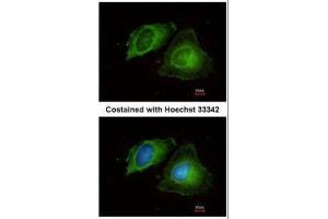 ICC/IF Image Immunofluorescence analysis of methanol-fixed HeLa, using MMP17, antibody at 1:200 dilution. (MMP17 anticorps)
