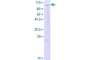 Image no. 1 for Zinc Finger and BTB Domain Containing 33 (ZBTB33) (AA 1-673) protein (GST tag) (ABIN1325601)