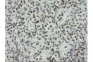 Image no. 3 for anti-Zinc Finger and SCAN Domain Containing 18 (ZSCAN18) antibody (ABIN1501857) (ZSCAN18 anticorps)