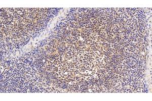 Detection of EP300 in Human Lymph node Tissue using Polyclonal Antibody to E1A Binding Protein P300 (EP300) (p300 anticorps  (AA 1351-1601))